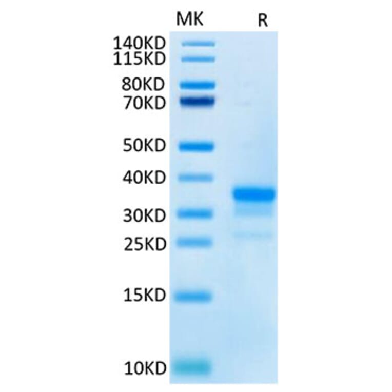 Tris-Bis PAGE - Recombinant Cynomolgus macaque CD40 Protein (C-terminal His Tag) (A331899) - Antibodies.com