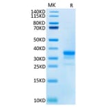 Tris-Bis PAGE - Recombinant Cynomolgus macaque CD40 Protein (C-terminal His Tag) (A331899) - Antibodies.com