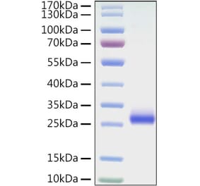 SDS-PAGE - Recombinant Mouse CD40 Protein (C-terminal His Tag) (A331900) - Antibodies.com