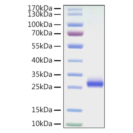 SDS-PAGE - Recombinant Mouse CD40 Protein (C-terminal His Tag) (A331900) - Antibodies.com