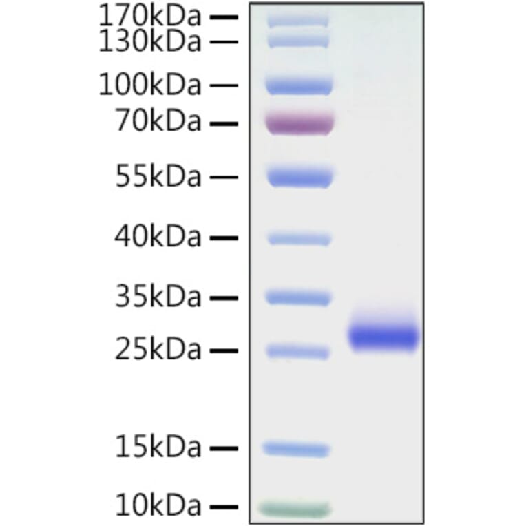 SDS-PAGE - Recombinant Mouse CD40 Protein (C-terminal His Tag) (A331900) - Antibodies.com