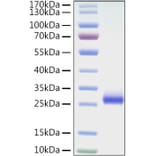 SDS-PAGE - Recombinant Mouse CD40 Protein (C-terminal His Tag) (A331900) - Antibodies.com