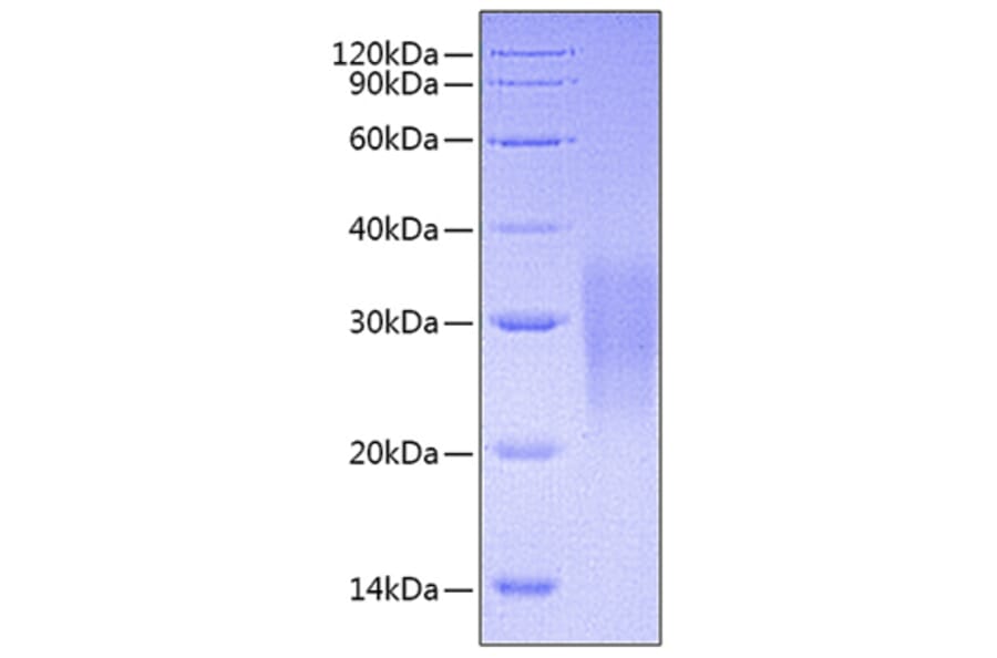SDS-PAGE - Recombinant Mouse Fas Protein (C-terminal His Tag) (A331901) - Antibodies.com