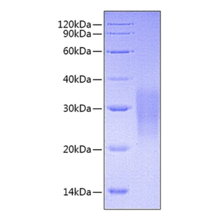 SDS-PAGE - Recombinant Mouse Fas Protein (C-terminal His Tag) (A331901) - Antibodies.com