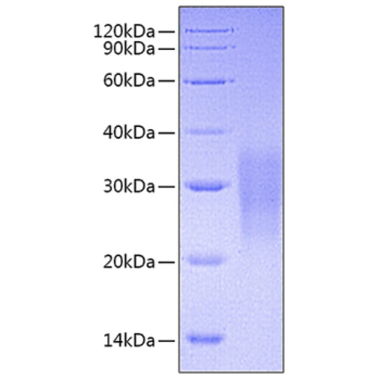 SDS-PAGE - Recombinant Mouse Fas Protein (C-terminal His Tag) (A331901) - Antibodies.com