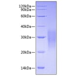 SDS-PAGE - Recombinant Mouse Fas Protein (C-terminal His Tag) (A331901) - Antibodies.com