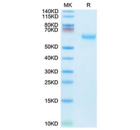 Tris-Bis PAGE - Recombinant Mouse CD27 Protein (C-terminal Mouse Fc Tag) (A331902) - Antibodies.com