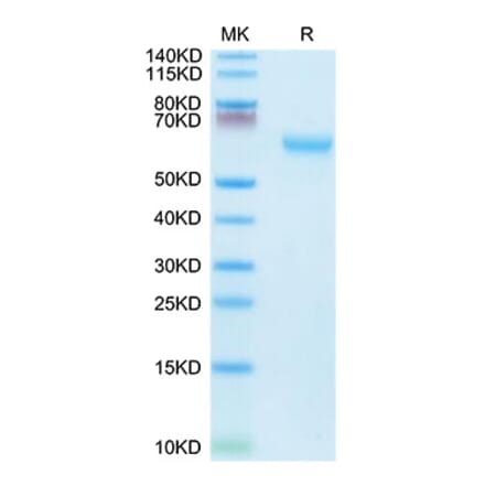 Tris-Bis PAGE - Recombinant Mouse CD27 Protein (C-terminal Mouse Fc Tag) (A331902) - Antibodies.com