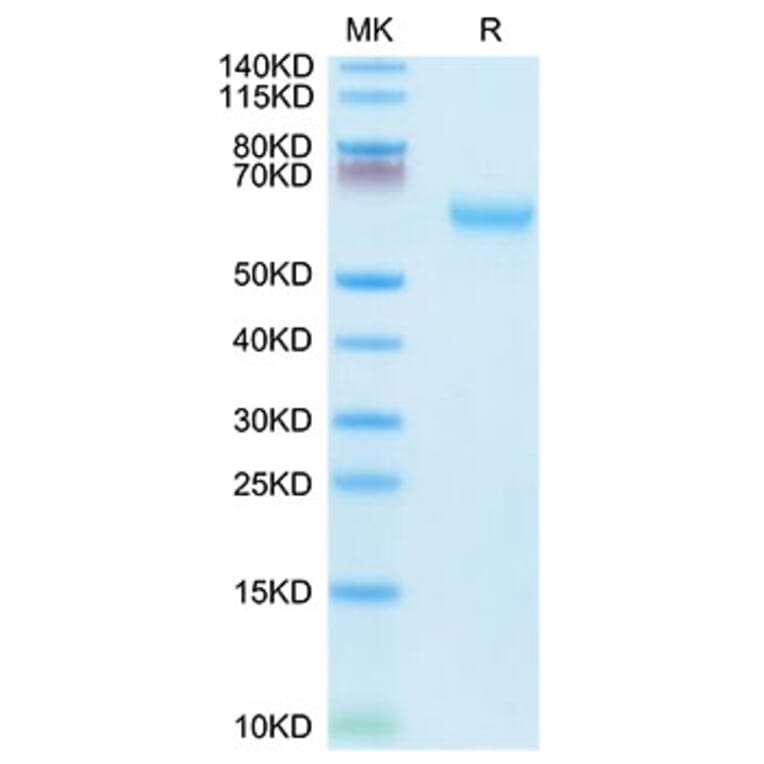 Tris-Bis PAGE - Recombinant Mouse CD27 Protein (C-terminal Mouse Fc Tag) (A331902) - Antibodies.com