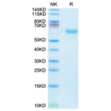 Tris-Bis PAGE - Recombinant Mouse CD27 Protein (C-terminal Mouse Fc Tag) (A331902) - Antibodies.com