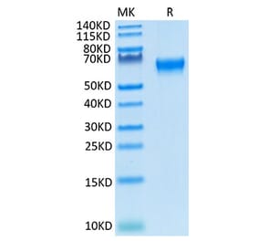 Tris-Bis PAGE - Recombinant Cynomolgus/Rhesus macaque CD27 Protein (C-terminal Human Fc Tag) (A331903) - Antibodies.com