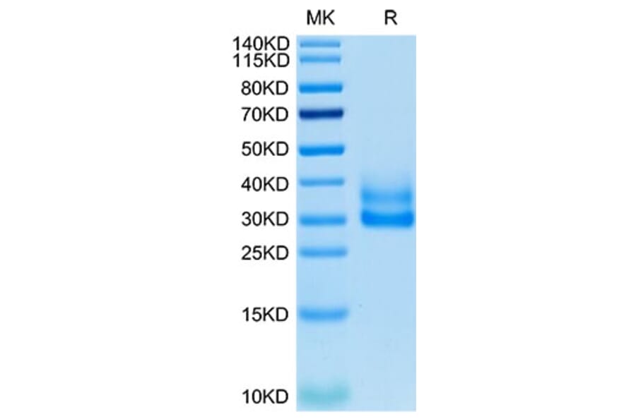 Tris-Bis PAGE - Recombinant Cynomolgus/Rhesus macaque TNFRSF9 Protein (C-terminal His Tag) (A331904) - Antibodies.com