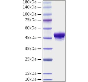 SDS-PAGE - Recombinant Mouse CD137 Protein (C-terminal His Tag) (A331906) - Antibodies.com