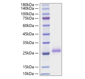 SDS-PAGE - Recombinant Mouse RANKL Protein (N-terminal His Tag) (A331907) - Antibodies.com