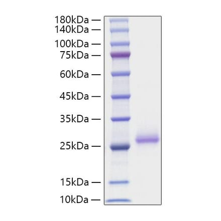 SDS-PAGE - Recombinant Mouse RANKL Protein (N-terminal His Tag) (A331907) - Antibodies.com