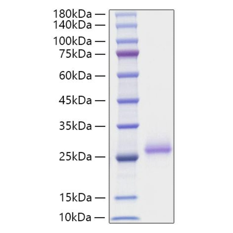 SDS-PAGE - Recombinant Mouse RANKL Protein (N-terminal His Tag) (A331907) - Antibodies.com