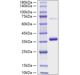 SDS-PAGE - Recombinant Mouse RANKL Protein (N-terminal His Tag) (A331908) - Antibodies.com
