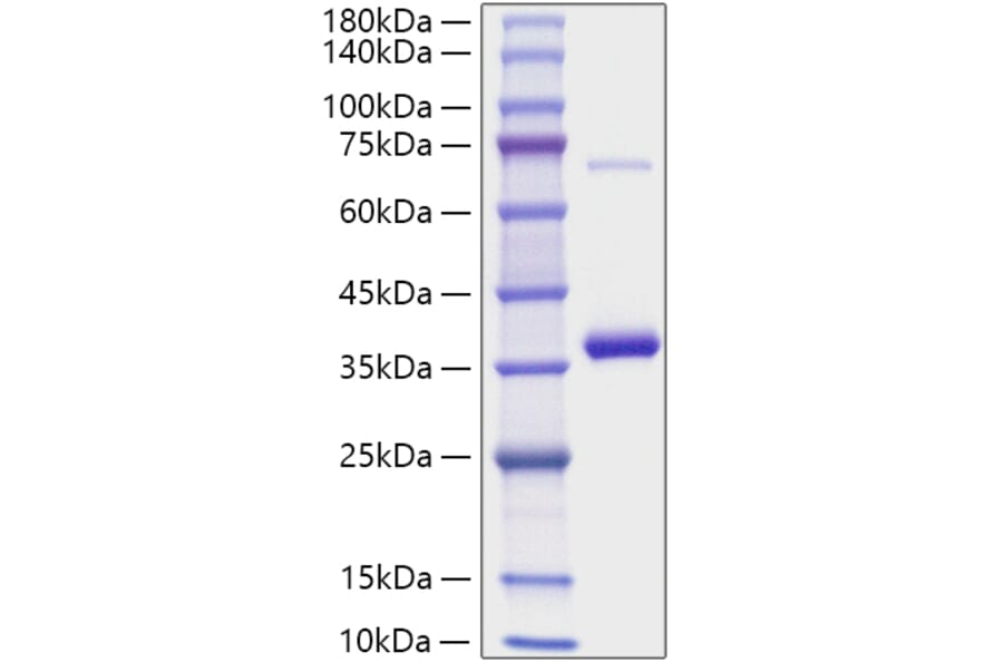 SDS-PAGE - Recombinant Mouse RANKL Protein (N-terminal His Tag) (A331908) - Antibodies.com