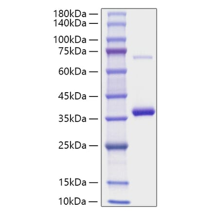 SDS-PAGE - Recombinant Mouse RANKL Protein (N-terminal His Tag) (A331908) - Antibodies.com