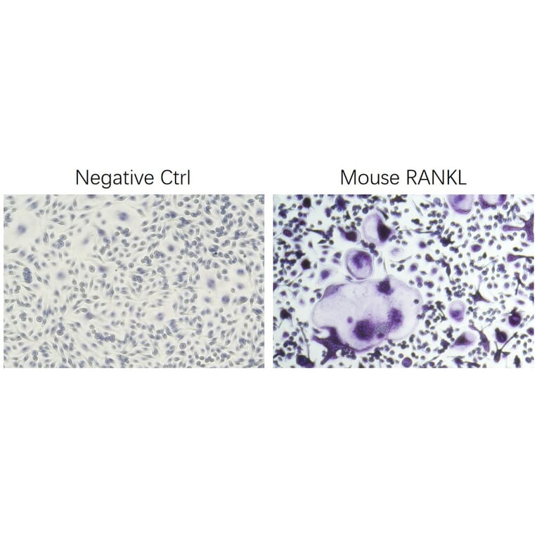ICC - Recombinant Mouse RANKL Protein (N-terminal His Tag) (A331908) - Antibodies.com