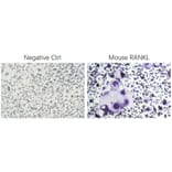 ICC - Recombinant Mouse RANKL Protein (N-terminal His Tag) (A331908) - Antibodies.com