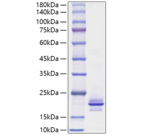 SDS-PAGE - Recombinant Mouse RANKL Protein (A331909) - Antibodies.com