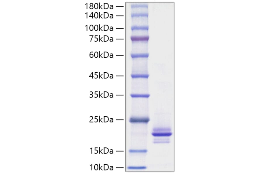 SDS-PAGE - Recombinant Mouse RANKL Protein (A331909) - Antibodies.com
