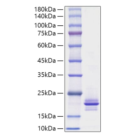 SDS-PAGE - Recombinant Mouse RANKL Protein (A331909) - Antibodies.com