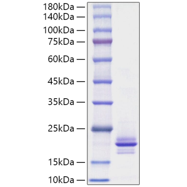 SDS-PAGE - Recombinant Mouse RANKL Protein (A331909) - Antibodies.com
