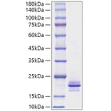 SDS-PAGE - Recombinant Mouse RANKL Protein (A331909) - Antibodies.com