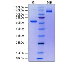 SDS-PAGE - Recombinant Mouse RANKL Protein (N-terminal His and Human FC Tag) (A331910) - Antibodies.com