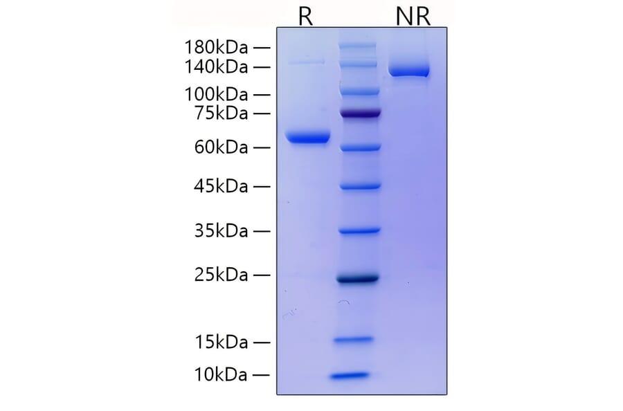SDS-PAGE - Recombinant Mouse RANKL Protein (N-terminal His and Human FC Tag) (A331910) - Antibodies.com
