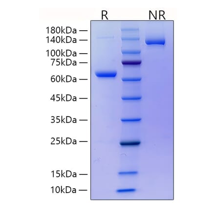 SDS-PAGE - Recombinant Mouse RANKL Protein (N-terminal His and Human FC Tag) (A331910) - Antibodies.com