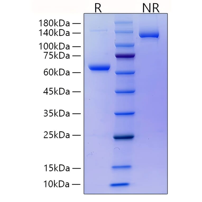 SDS-PAGE - Recombinant Mouse RANKL Protein (N-terminal His and Human FC Tag) (A331910) - Antibodies.com