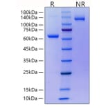 SDS-PAGE - Recombinant Mouse RANKL Protein (N-terminal His and Human FC Tag) (A331910) - Antibodies.com