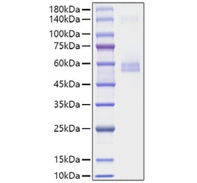 SDS-PAGE - Recombinant Mouse TNFSF13 Protein (C-terminal Human Fc Tag) (A331912) - Antibodies.com