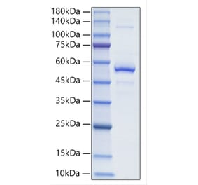 SDS-PAGE - Recombinant Mouse BAFF Protein (N-terminal Human Fc and His Tag) (A331913) - Antibodies.com