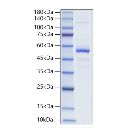 SDS-PAGE - Recombinant Mouse BAFF Protein (N-terminal Human Fc and His Tag) (A331913) - Antibodies.com