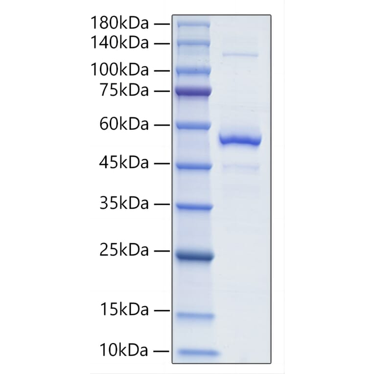 SDS-PAGE - Recombinant Mouse BAFF Protein (N-terminal Human Fc and His Tag) (A331913) - Antibodies.com