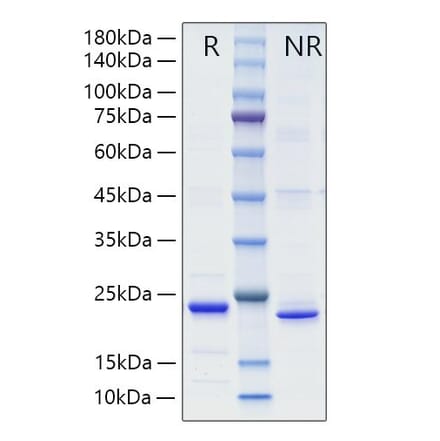 SDS-PAGE - Recombinant Mouse TL1A Protein (A331914) - Antibodies.com
