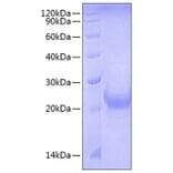 SDS-PAGE - Recombinant Mouse OX40L Protein (N-terminal His Tag) (A331915) - Antibodies.com