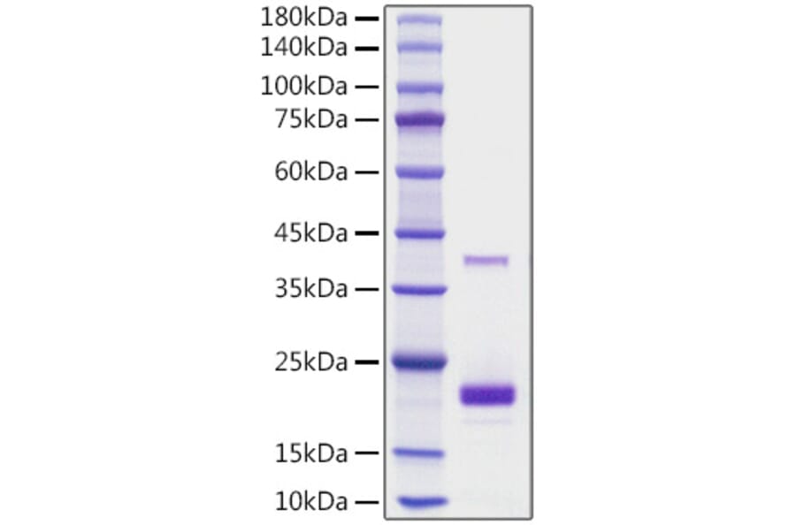 SDS-PAGE - Recombinant Mouse TNFSF5 Protein (N-terminal His Tag) (A331916) - Antibodies.com