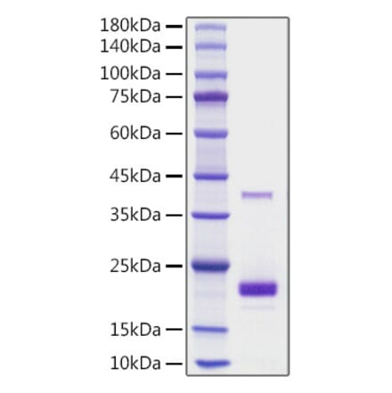 SDS-PAGE - Recombinant Mouse TNFSF5 Protein (N-terminal His Tag) (A331916) - Antibodies.com