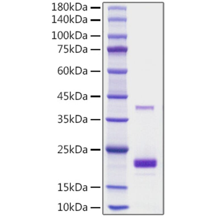 SDS-PAGE - Recombinant Mouse TNFSF5 Protein (N-terminal His Tag) (A331916) - Antibodies.com