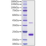 SDS-PAGE - Recombinant Mouse TNFSF5 Protein (N-terminal His Tag) (A331916) - Antibodies.com