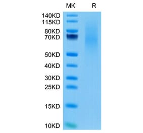 Tris-Bis PAGE - Recombinant Cynomolgus macaque CD70 Protein (N-terminal His Tag) (A331918) - Antibodies.com