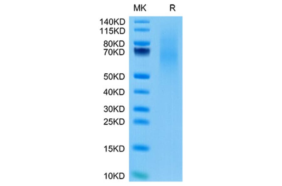 Tris-Bis PAGE - Recombinant Cynomolgus macaque CD70 Protein (N-terminal His Tag) (A331918) - Antibodies.com