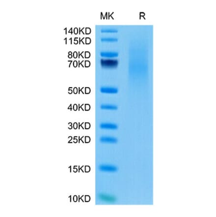 Tris-Bis PAGE - Recombinant Cynomolgus macaque CD70 Protein (N-terminal His Tag) (A331918) - Antibodies.com