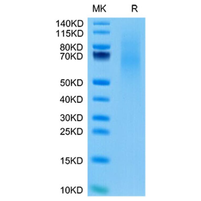 Tris-Bis PAGE - Recombinant Cynomolgus macaque CD70 Protein (N-terminal His Tag) (A331918) - Antibodies.com
