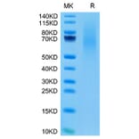 Tris-Bis PAGE - Recombinant Cynomolgus macaque CD70 Protein (N-terminal His Tag) (A331918) - Antibodies.com